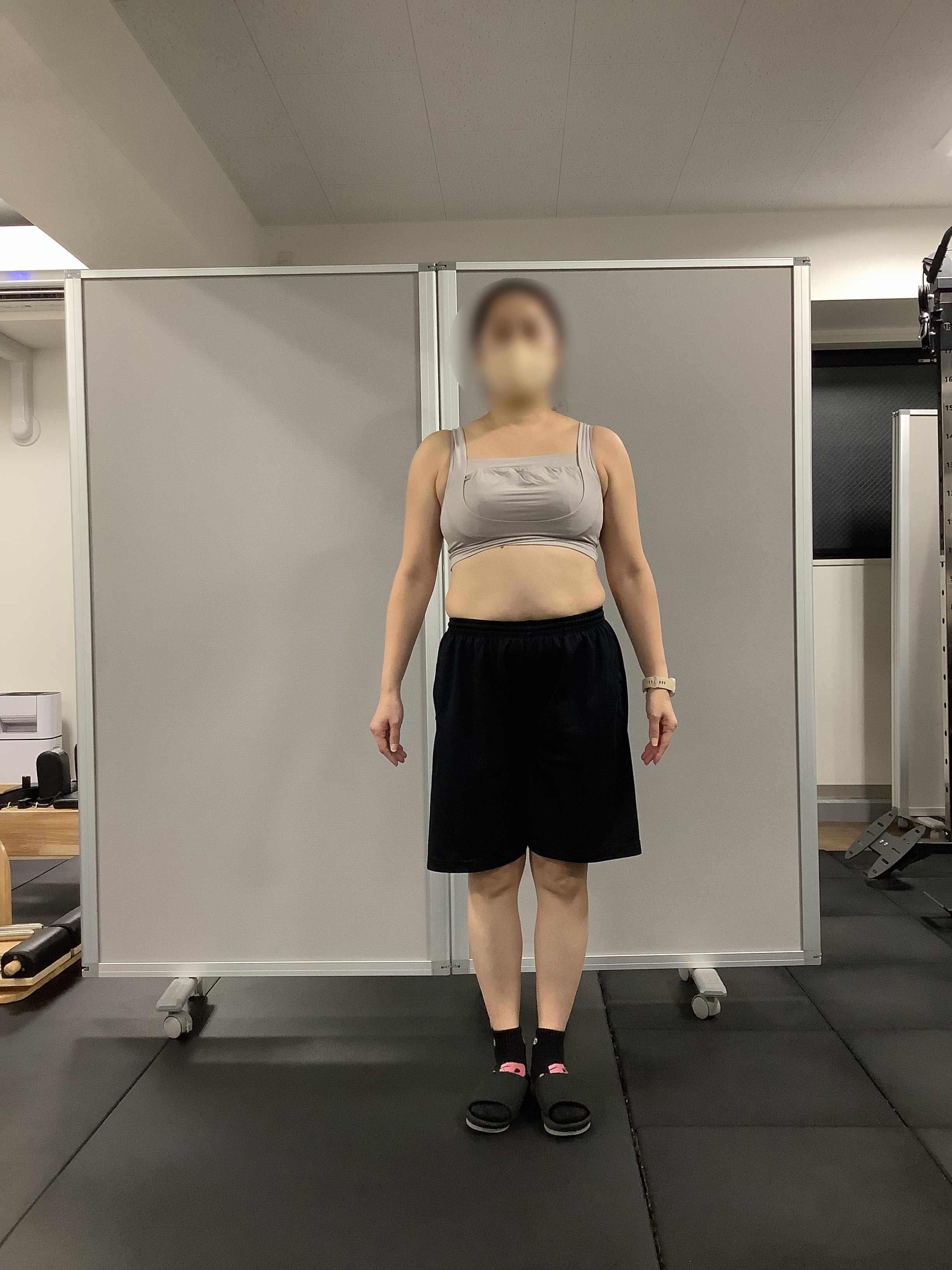 的確なアドバイスで前向きに継続 BEFORE