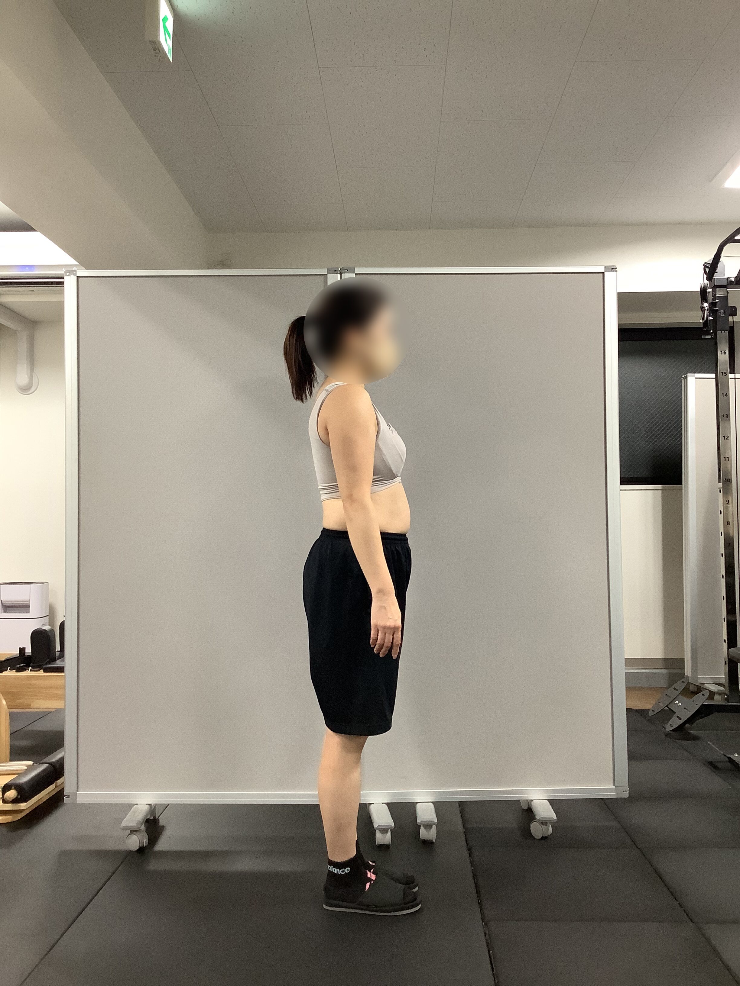 的確なアドバイスで前向きに継続 BEFORE