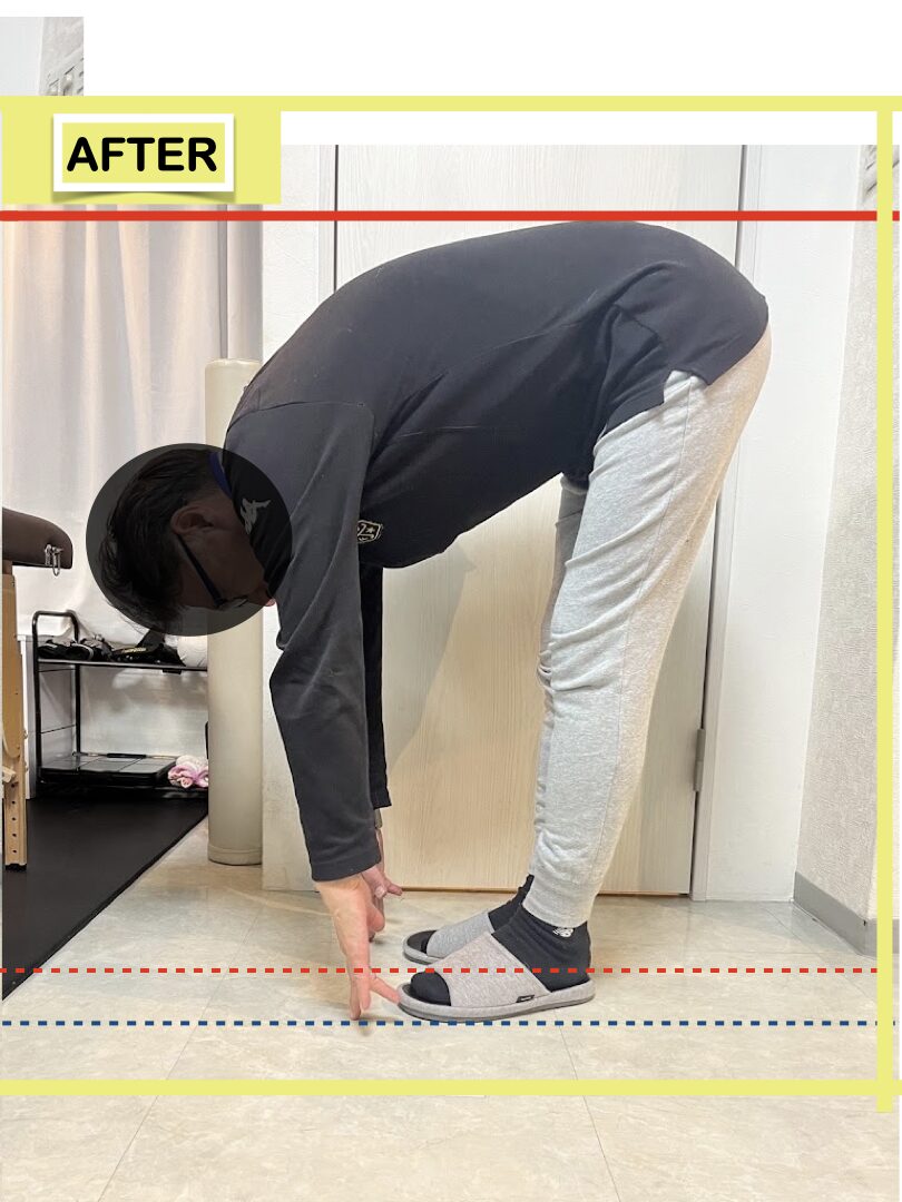 痛みに配慮した丁寧なストレッチ