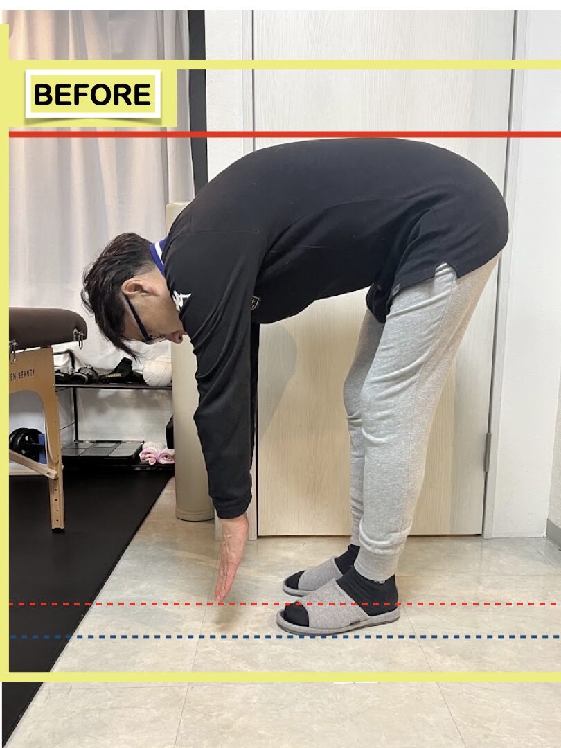 痛みに配慮した丁寧なストレッチ